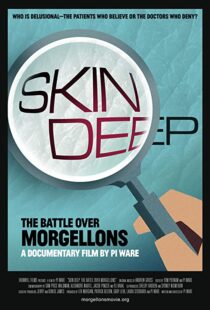 دانلود مستند Skin Deep: The Battle Over Morgellons 2019104233-876460007